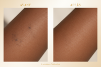 Avant/Après peau mate